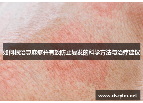 如何根治荨麻疹并有效防止复发的科学方法与治疗建议